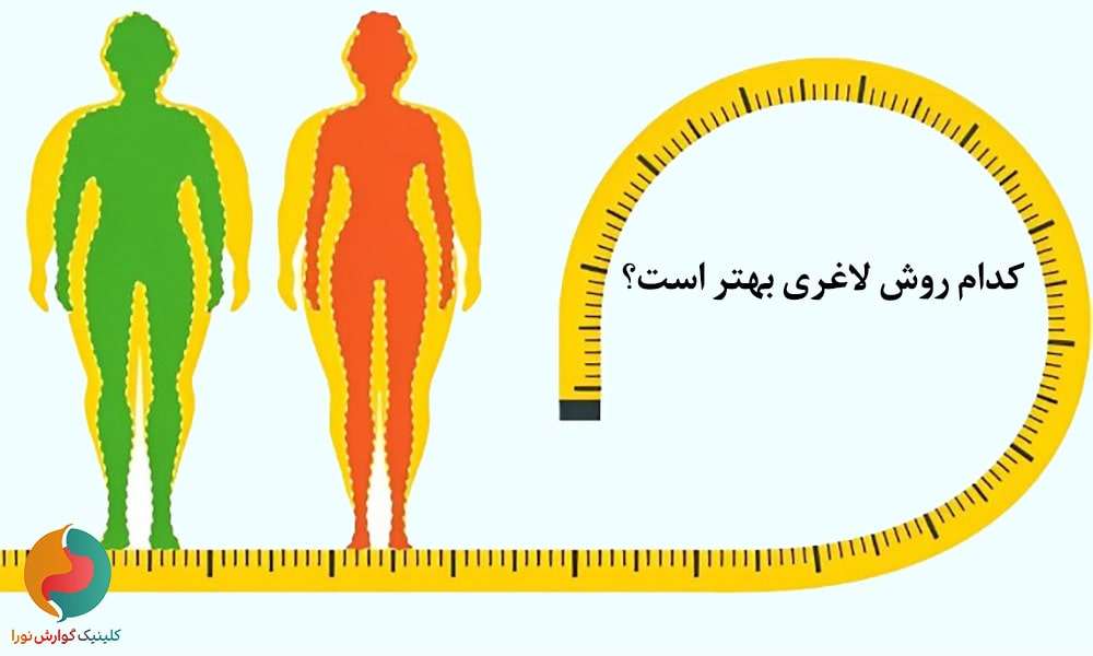 بوتاکس، بالن یا اسلیو؟