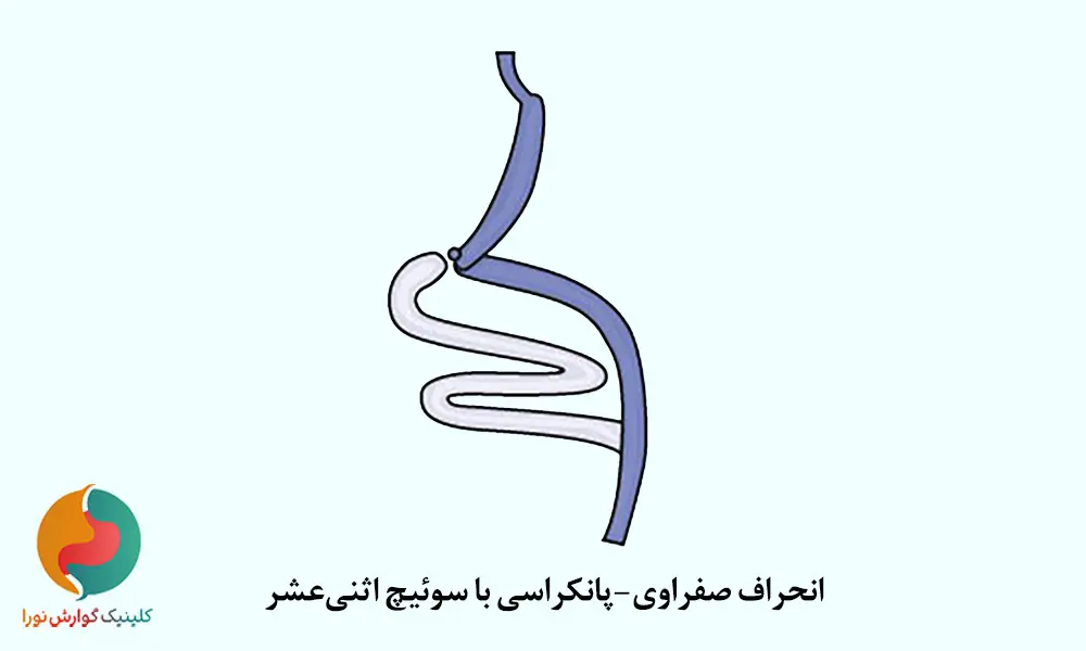 سوئیچ اثنی‌عشر