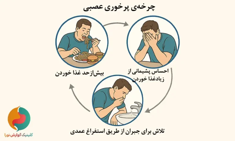 پرخوری عصبی