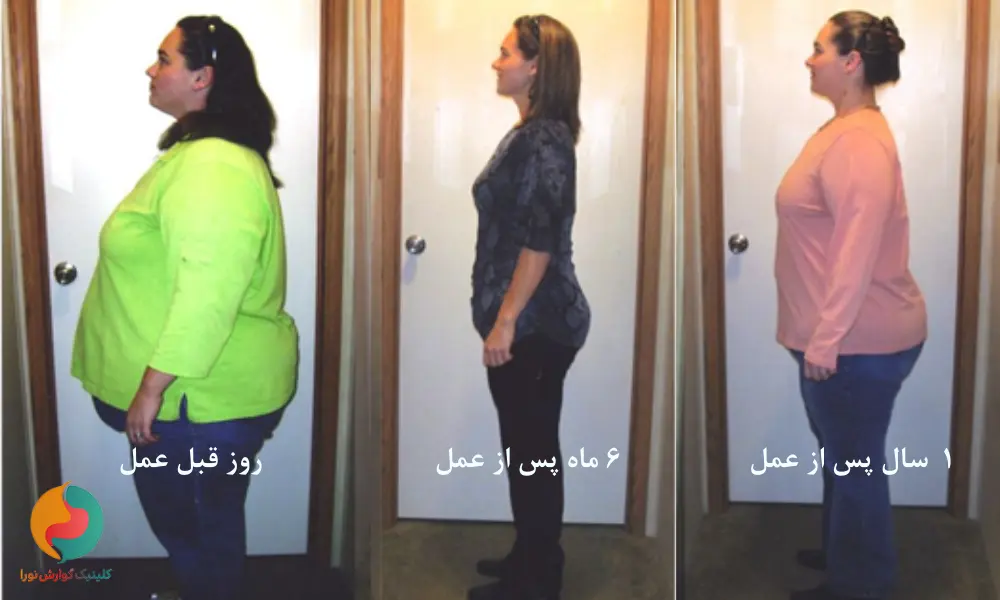 بازگشت وزن