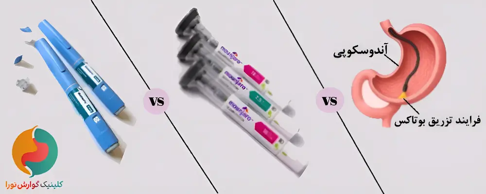 مقایسه مانجارو، اوزمپیک و بوتاکس معده
